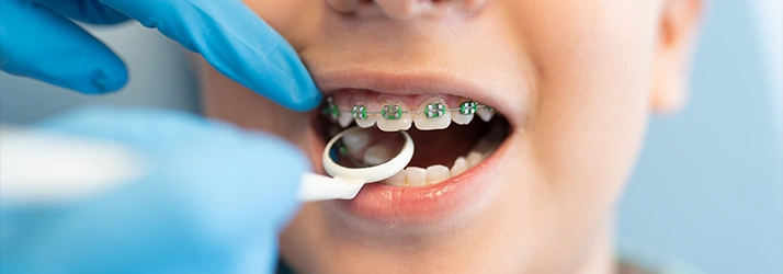 The Benefits of Early Orthodontic Treatment In The Woodlands TX for Kids