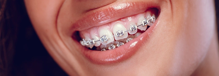 How Early Should Your Child See an Orthodontist In The Woodlands TX? How Early Should Your Child See an Orthodontist In The Woodlands TX?