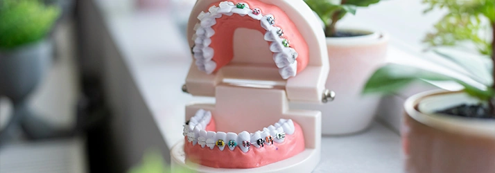 FC – Your Journey to Proper Orthodontic Treatment: Regular Braces at Showtime Orthodontics FC – Your Journey to Proper Orthodontic Treatment: Regular Braces at Showtime Orthodontics