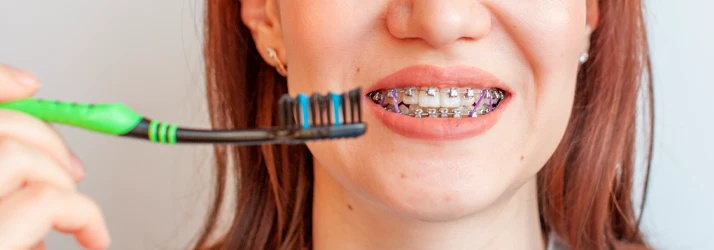 Braces Care & Comfort Guide In The Woodlands TX